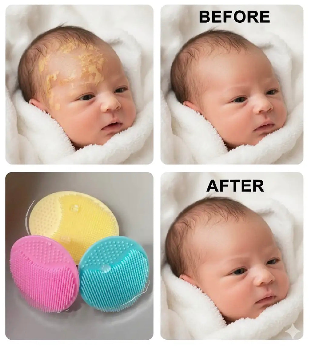 Dandruff Removal Brush